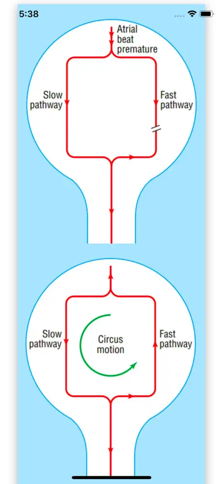ECG Basics Lite: ECG Made Easy