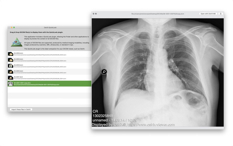 Screenshot #1 pour DICOM Quicklook by OsiriX