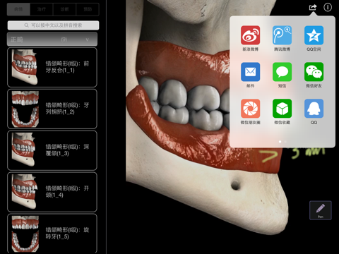 3D口腔医患沟通 screenshot 3