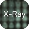 X-Ray Differential Diagnosis app icon - Medical app for iPhone