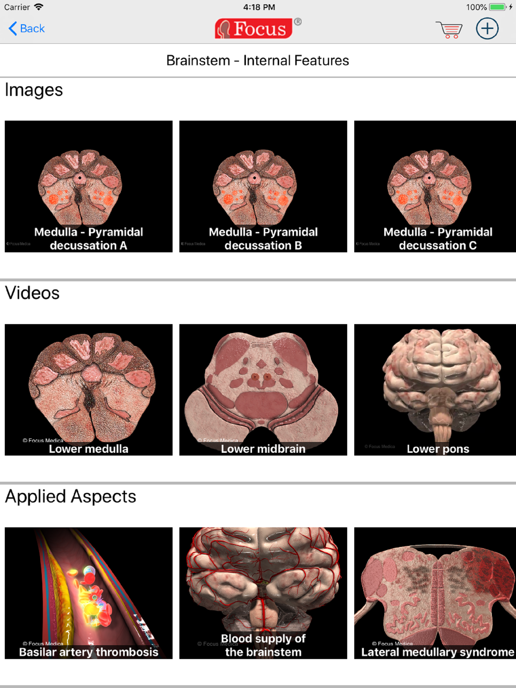 NEUROANATOMY - Digital Anatomy screenshot 8