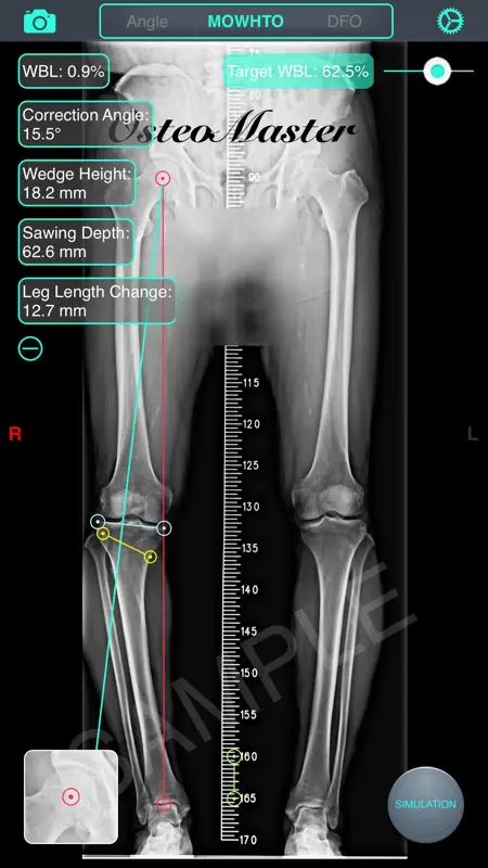 OsteoMaster screenshot 2 of 5