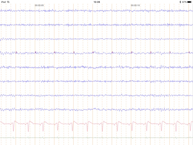 BluePod screenshot-7