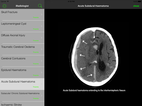 iRadiologist - Brain screenshot 3