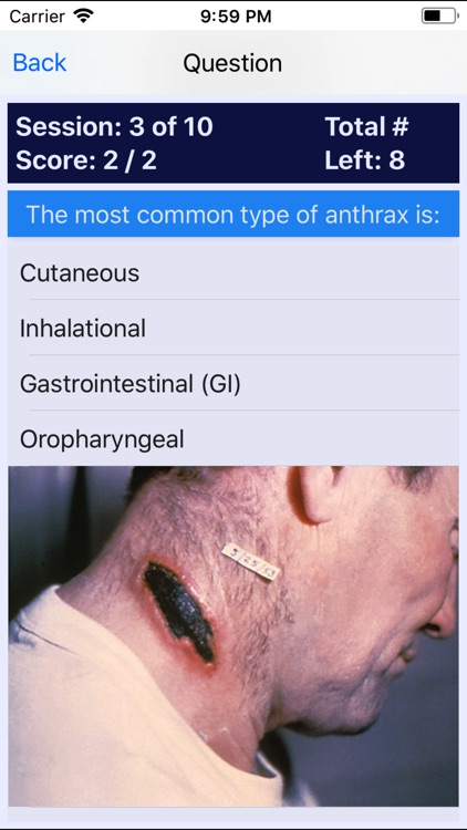 Emergency Nurse Review