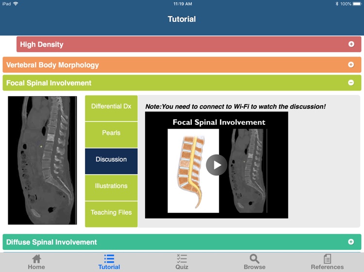 CTisus L-Spine Pathology screenshot-3