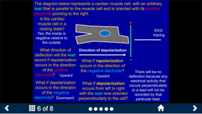 EKG - SecondLook screenshot