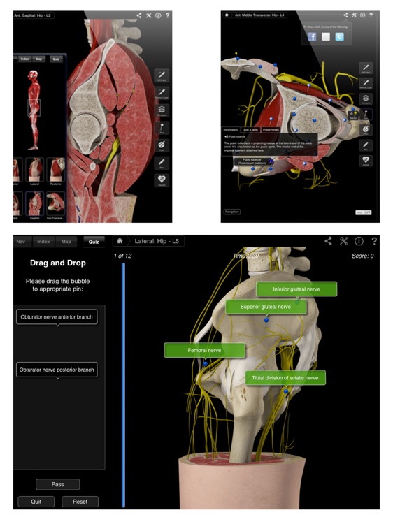 Hip Pro III for iPad screenshot-4