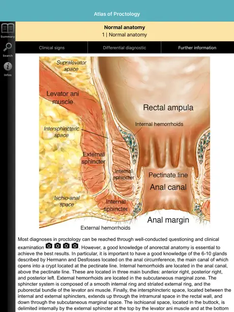 Atlas of Proctology