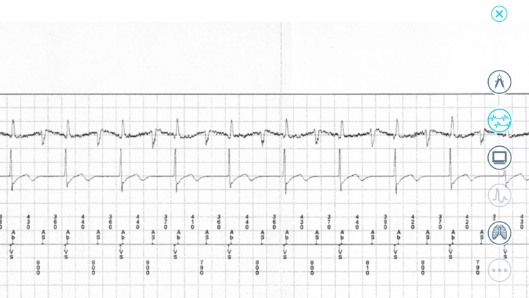 Cardiac Device Challenge