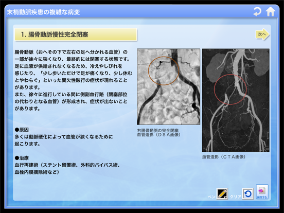 末梢動脈3Dアトラスのおすすめ画像5