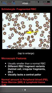 Hematology Outlines Atlas screenshot #5 for iPhone