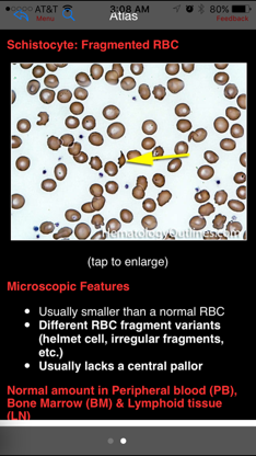 Hematology Outlines Atlas screenshot 5
