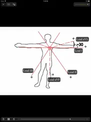 ecgsource ipad resimleri 4
