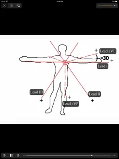 ECGsource iPad image 4