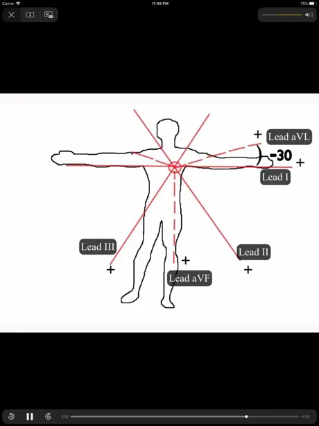 ECGsource