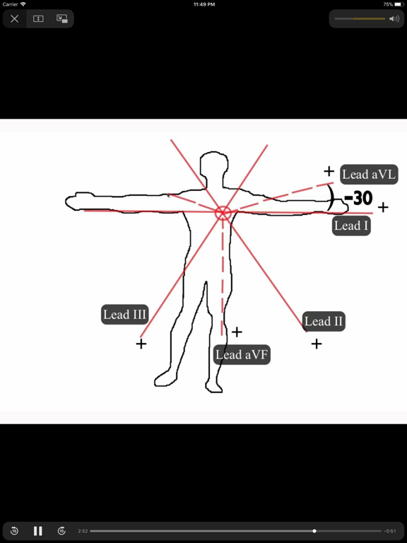 ECGsourceのおすすめ画像4