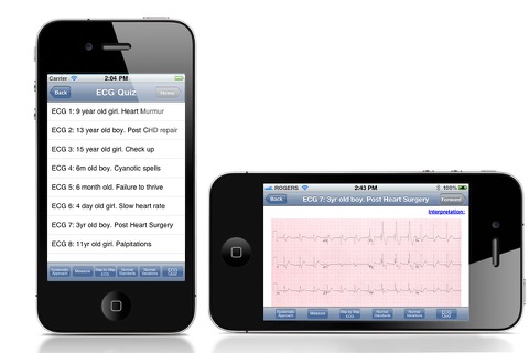 Rapid Paed ECG - náhled