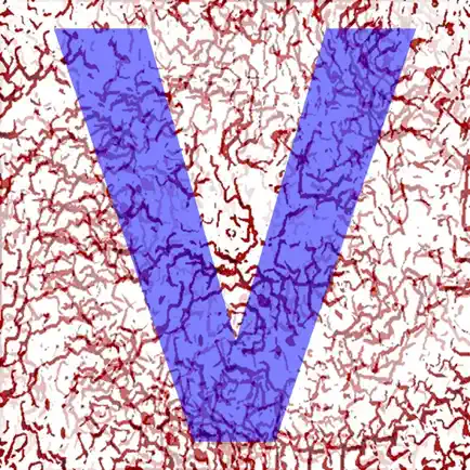 Vibrometer Читы