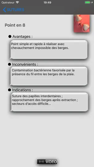 Capture d'écran de Sutures Vidéos sur iPhone 1