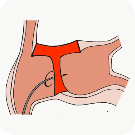 TRANSEPTAID Читы
