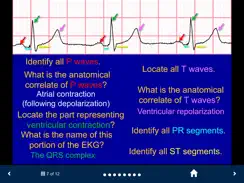 EKG - SecondLook iPad image 3