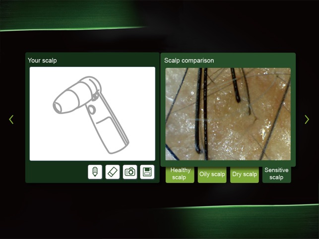 Scalp Analyzer(圖3)-速報App