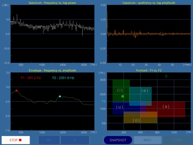 Onmon - Audio & Voice Analyzer(圖7)-速報App