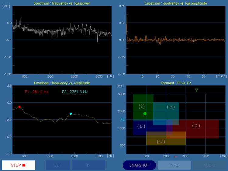 Onmon - Audio & Voice Analyzer screenshot-6