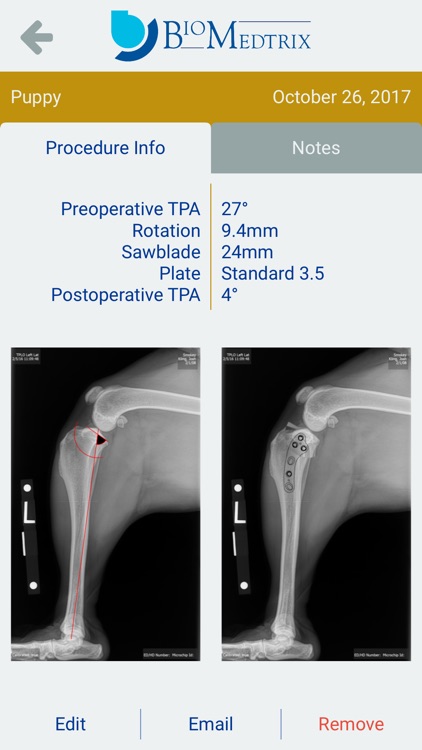TPLO Templating