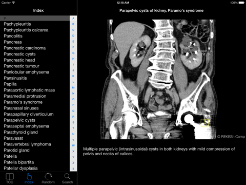 Atlas of Radiological Images screenshot 2