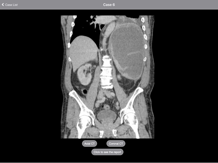 Radiology 2.0: Cases from the End of the World