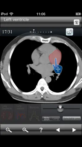 Game screenshot Chest CT Sectional Walker mod apk