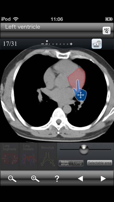 Chest CT Sectional Walker Screenshot 1