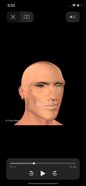 Head and Neck(圖5)-速報App