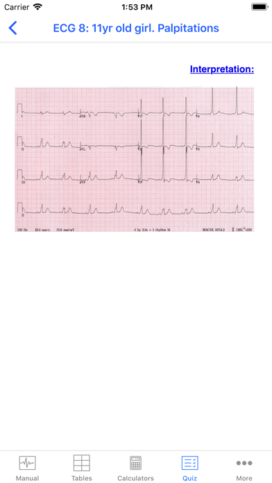 Screenshot #5 for Rapid Paed ECG
