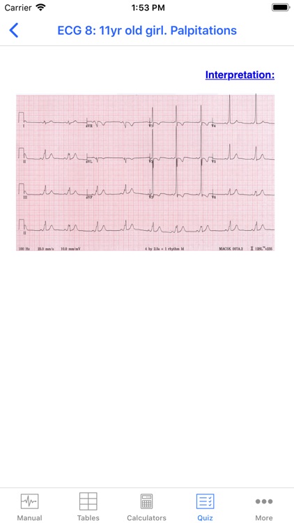 Rapid Paed ECG screenshot-4