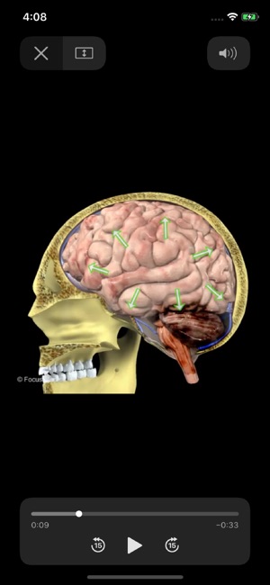 NEUROANATOMY - Digital Anatomy(圖5)-速報App