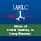 In this app, users are provided with “know-how” information on EGFR testing as well as the “know-why” information about how to interpret the results