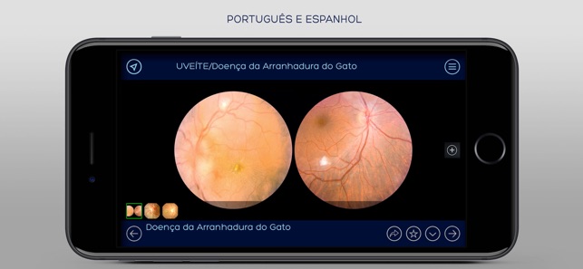 Banco de Imagens Oftalmologia(圖3)-速報App