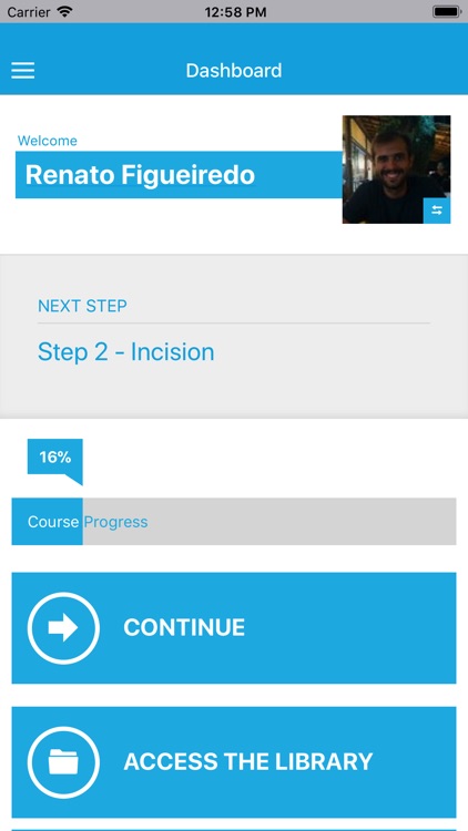 IORT - Shoulder Arthroplasty