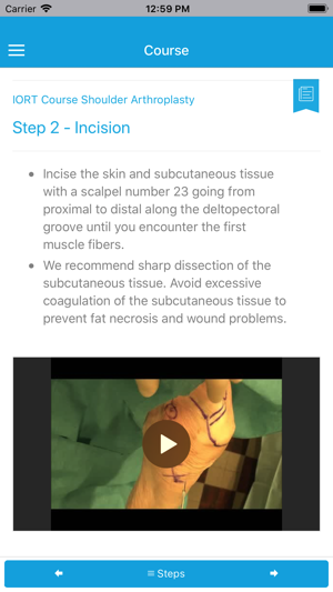 IORT - Shoulder Arthroplasty(圖4)-速報App