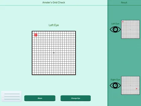 Vision Scan Lite