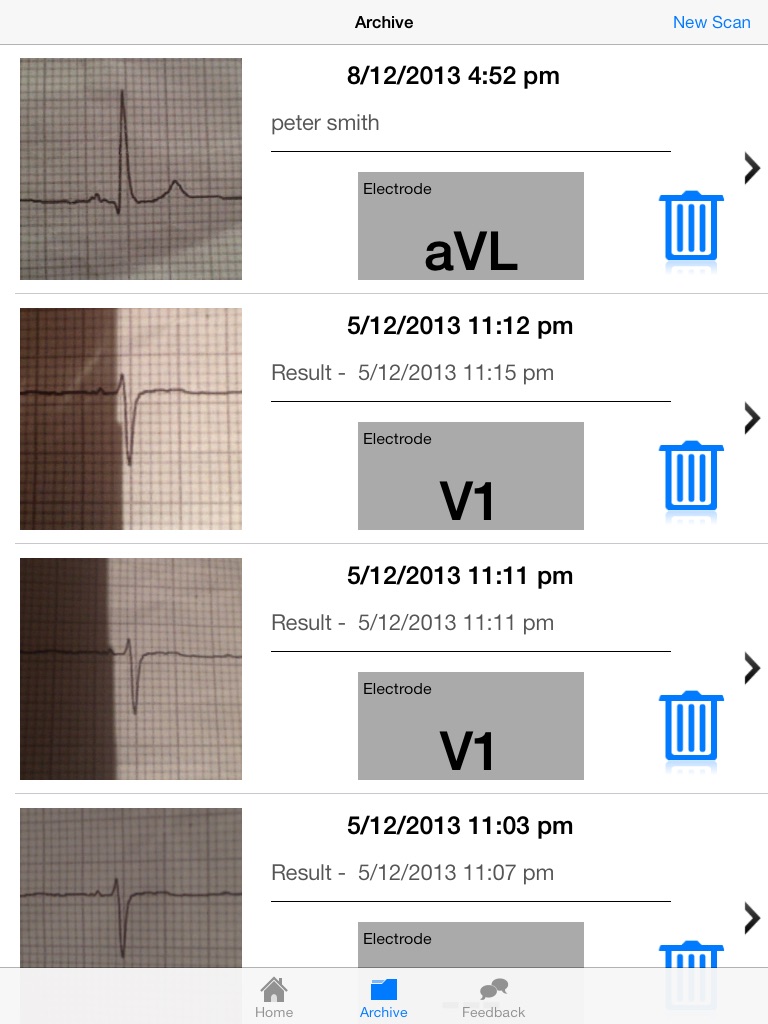 Doctor ECG guide & calculator screenshot 4