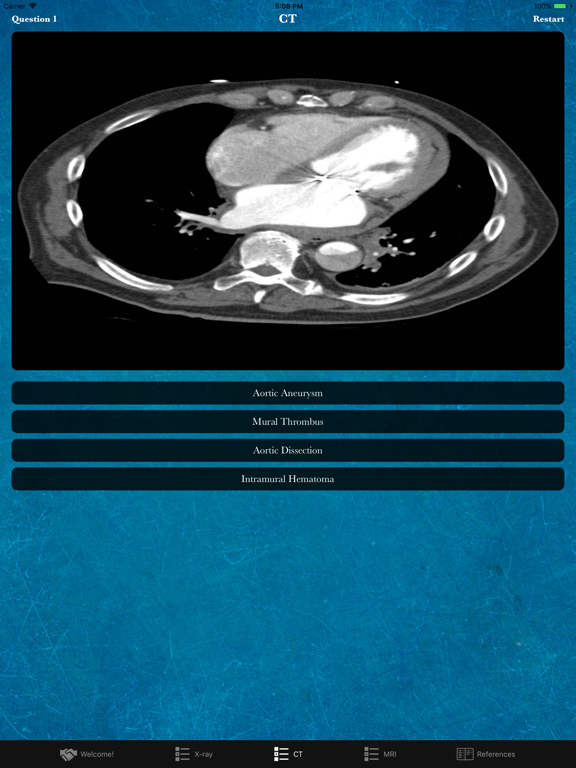 Rad Quiz iPad screenshot 3 - Education app