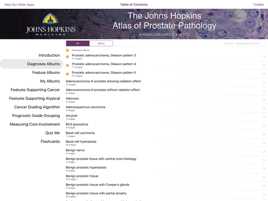 Screenshot #4 pour Hopkins Prostate Pathology