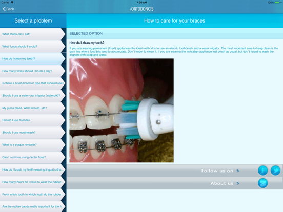iOrtodoncis iPad screenshot 3 - Medical app
