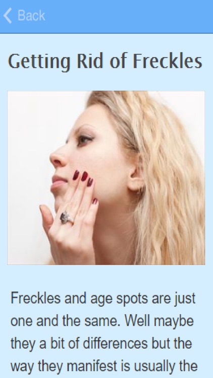 How To Get Rid Of Freckles