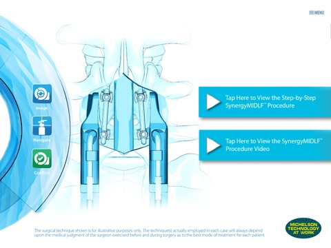 Surgical Synergy Spinal Workflow screenshot 4