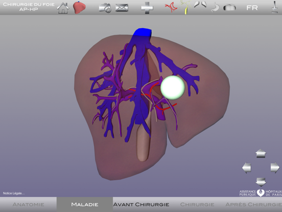 Screenshot #4 pour Chirurgie du foie AP-HP